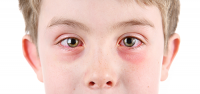 pink eye | conjunctivitis | photo of boy with pink eye