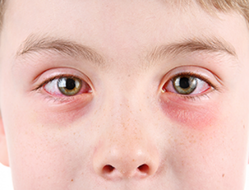 Prevent Pink Eye – Students