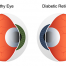 low vision | diagram showing a healthy eye vs. a diabetic eye