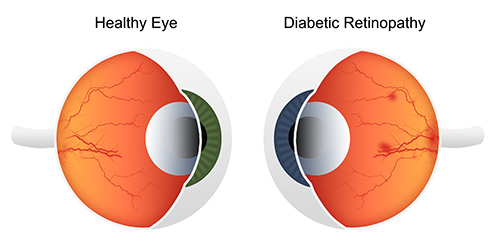 About the Eye, Eye Care Atlanta, Retina Care Atlanta