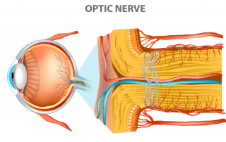 optic neuropathy | medical illustration of optic nerve