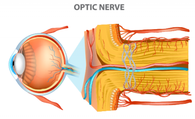 optic neuropathy | medical illustration of optic nerve