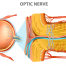 optic neuropathy | medical illustration of optic nerve