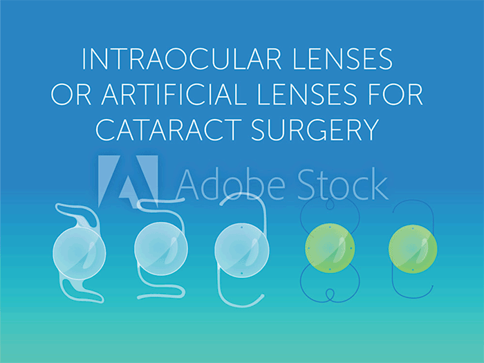 IOL Intraocular lens